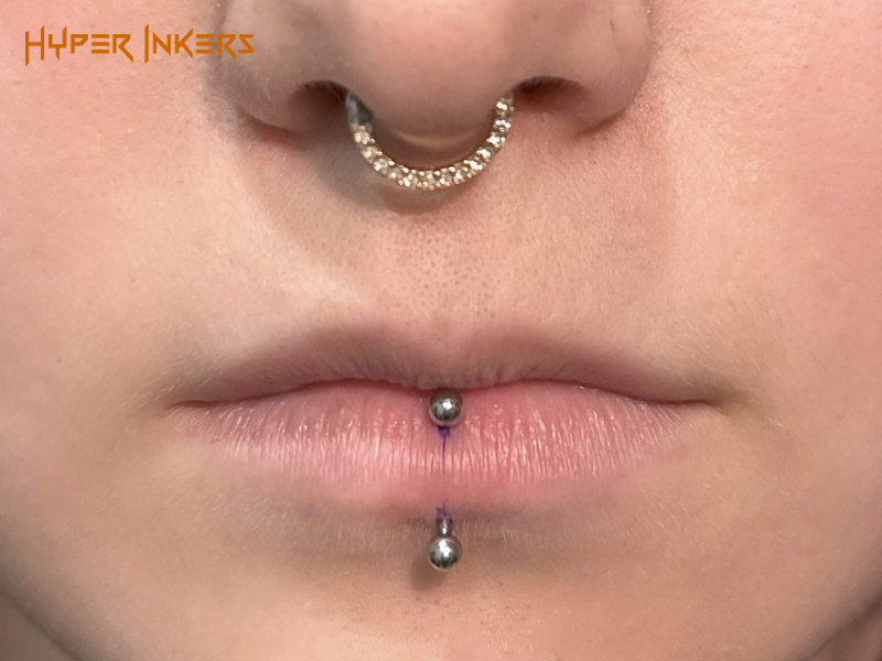 Proper Aftercare: Your Defense Against Complications 