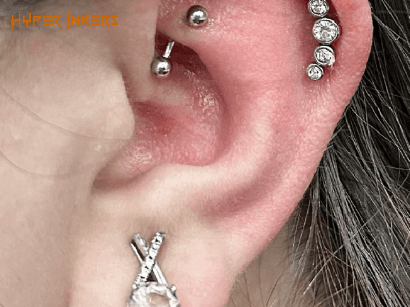 Allergic Reactions to Jewelry Materials