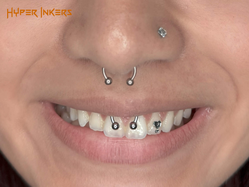 Oral Frenulum Piercings